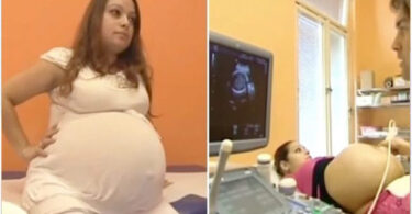 23-Year Old Mother Made History With A Birth That Only Happens Every 480 Years