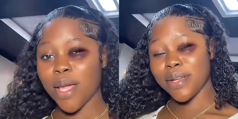 “My man apologizes with frontal every time he beats me” — Lady reveals